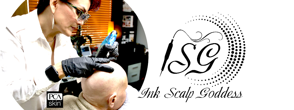 Scalp Micropigmentation For Hair Loss - Ink Scalp Goddess